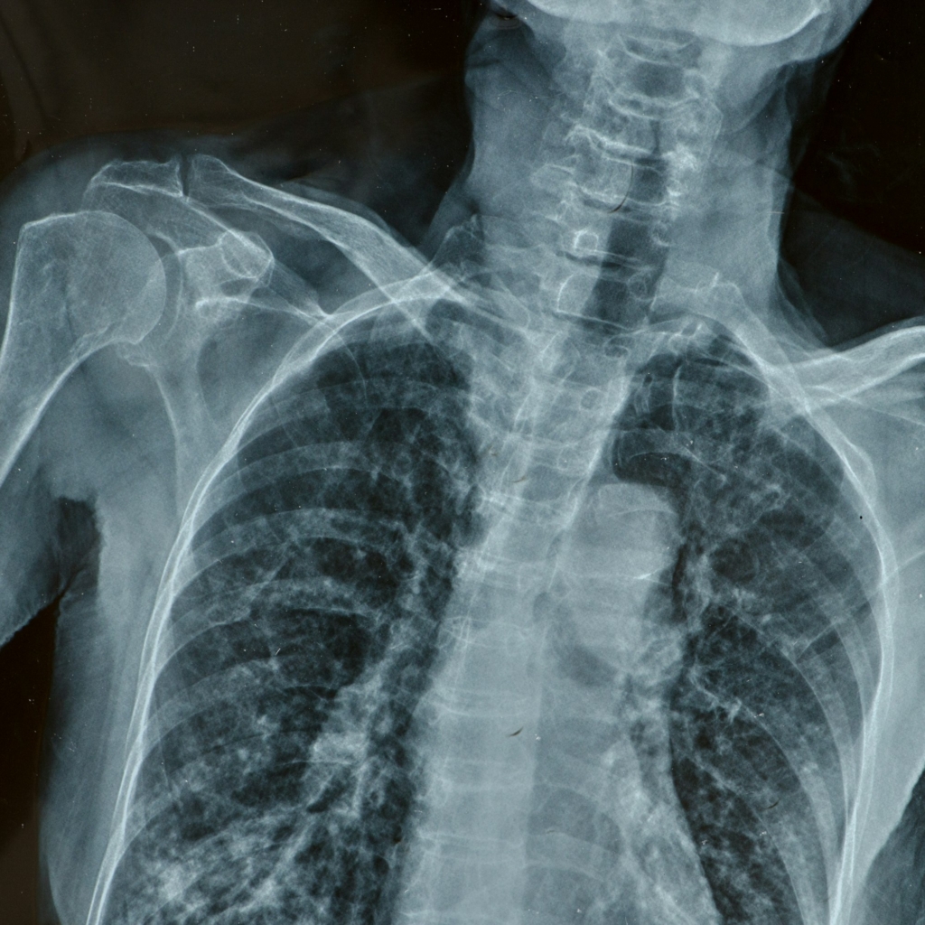 x-rays for barium swallow test
